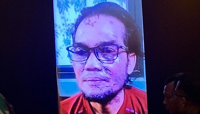 Sidang Kasus Penyiraman Air Keras Tampilkan Bukti Foto Kondisi Terdakwa
